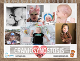 SALE - 2021 CAPPS Craniosynostosis Calendar