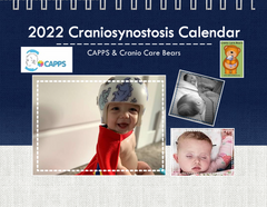 2022 CAPPS Craniosynostosis Calendar